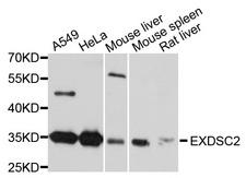 EXOSC2 / RRP4 Antibody - Western blot analysis of extracts of various cell lines, using EXOSC2 antibody at 1:1000 dilution. The secondary antibody used was an HRP Goat Anti-Rabbit IgG (H+L) at 1:10000 dilution. Lysates were loaded 25ug per lane and 3% nonfat dry milk in TBST was used for blocking. An ECL Kit was used for detection and the exposure time was 5s.
