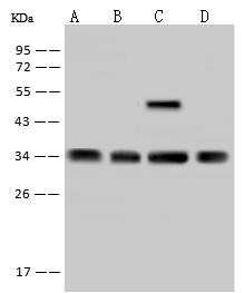 EXOSC2 / RRP4 Antibody - Anti-EXOSC2 rabbit polyclonal antibody at 1:500 dilution. Lane A: 293T Whole Cell Lysate. Lane B: Hela Whole Cell Lysate. Lane C: Jurkat Whole Cell Lysate. Lysates/proteins at 30 ug per lane. Secondary: Goat Anti-Rabbit IgG (H+L)/HRP at 1/10000 dilution. Developed using the ECL technique. Performed under reducing conditions. Predicted band size: 33 kDa. Observed band size: 33 kDa.