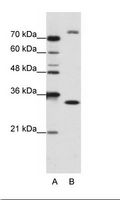 EXOSC2 / RRP4 Antibody - B: Jurkat Cell Lysate.  This image was taken for the unconjugated form of this product. Other forms have not been tested.