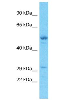 EXOSC3 Antibody - EXOSC3 / p10 antibody Western Blot of Esophagus Tumor. Antibody dilution: 1 ug/ml.  This image was taken for the unconjugated form of this product. Other forms have not been tested.