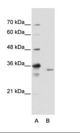 EXOSC3 Antibody - B: HepG2 Cell Lysate.  This image was taken for the unconjugated form of this product. Other forms have not been tested.