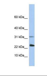 EXOSC3 Antibody - Placenta lysate. Antibody concentration: 1.0 ug/ml. Gel concentration: 10-20%.  This image was taken for the unconjugated form of this product. Other forms have not been tested.