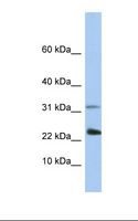 EXOSC3 Antibody - Placenta lysate. Antibody concentration: 1.0 ug/ml. Gel concentration: 10-20%.  This image was taken for the unconjugated form of this product. Other forms have not been tested.