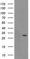 EXOSC3 Antibody - HEK293T cells were transfected with the pCMV6-ENTRY control (Left lane) or pCMV6-ENTRY EXOSC3 (Right lane) cDNA for 48 hrs and lysed. Equivalent amounts of cell lysates (5 ug per lane) were separated by SDS-PAGE and immunoblotted with anti-EXOSC3.