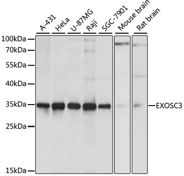 EXOSC3 Antibody - Western blot analysis of extracts of various cell lines, using EXOSC3 antibody at 1:1000 dilution. The secondary antibody used was an HRP Goat Anti-Rabbit IgG (H+L) at 1:10000 dilution. Lysates were loaded 25ug per lane and 3% nonfat dry milk in TBST was used for blocking. An ECL Kit was used for detection and the exposure time was 1s.