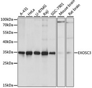 EXOSC3 Antibody - Western blot analysis of extracts of various cell lines, using EXOSC3 antibody at 1:1000 dilution. The secondary antibody used was an HRP Goat Anti-Rabbit IgG (H+L) at 1:10000 dilution. Lysates were loaded 25ug per lane and 3% nonfat dry milk in TBST was used for blocking. An ECL Kit was used for detection and the exposure time was 1s.