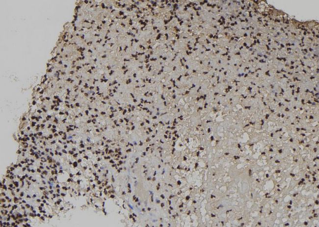 EXOSC3 Antibody - 1:100 staining human spleen tissue by IHC-P. The sample was formaldehyde fixed and a heat mediated antigen retrieval step in citrate buffer was performed. The sample was then blocked and incubated with the antibody for 1.5 hours at 22°C. An HRP conjugated goat anti-rabbit antibody was used as the secondary.