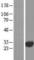 EXOSC3 Protein - Western validation with an anti-DDK antibody * L: Control HEK293 lysate R: Over-expression lysate