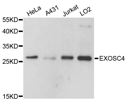 EXOSC4 / RRP41 Antibody - Western blot analysis of extracts of various cell lines.