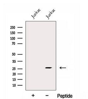 EXOSC4 / RRP41 Antibody - Western blot analysis of extracts of Jurkat cells using EXOSC4 antibody. The lane on the left was treated with blocking peptide.