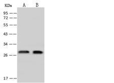EXOSC4 / RRP41 Antibody - Anti-EXOSC4 rabbit polyclonal antibody at 1:500 dilution. Lane A: U-251 MG Whole Cell Lysate. Lane B: HeLa Whole Cell Lysate. Lysates/proteins at 30 ug per lane. Secondary: Goat Anti-Rabbit IgG (H+L)/HRP at 1/10000 dilution. Developed using the ECL technique. Performed under reducing conditions. Predicted band size: 26 kDa. Observed band size: 29 kDa.