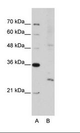 EXOSC4 / RRP41 Antibody - A: Marker, B: Jurkat Cell Lysate.  This image was taken for the unconjugated form of this product. Other forms have not been tested.
