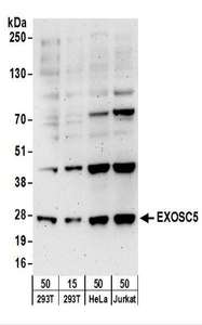 EXOSC5 Antibody - Detection of Human EXOSC5 by Western Blot. Samples: Whole cell lysate from 293T (15 and 50 ug), HeLa (50 ug), and Jurkat (50 ug) cells. Antibodies: Affinity purified rabbit anti-EXOSC5 antibody used for WB at 0.1 ug/ml. Detection: Chemiluminescence with an exposure time of 3 minutes.