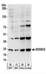EXOSC5 Antibody - Detection of Human EXOSC5 by Western Blot. Samples: Whole cell lysate from 293T (15 and 50 ug), HeLa (50 ug), and Jurkat (50 ug) cells. Antibodies: Affinity purified rabbit anti-EXOSC5 antibody used for WB at 0.1 ug/ml. Detection: Chemiluminescence with an exposure time of 3 minutes.