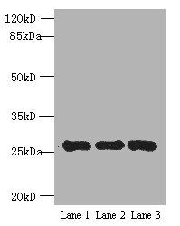 EXOSC5 Antibody - Western blot All lanes: EXOSC5 antibody at 5µg/ml Lane 1: K562 whole cell lysate Lane 2: 293T whole cell lysate Lane 3: Hela whole cell lysate Secondary Goat polyclonal to rabbit IgG at 1/10000 dilution Predicted band size: 25 kDa Observed band size: 25 kDa