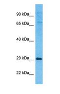 EXOSC5 Antibody - Western blot of EXOS5 Antibody with human 721_B Whole Cell lysate.  This image was taken for the unconjugated form of this product. Other forms have not been tested.