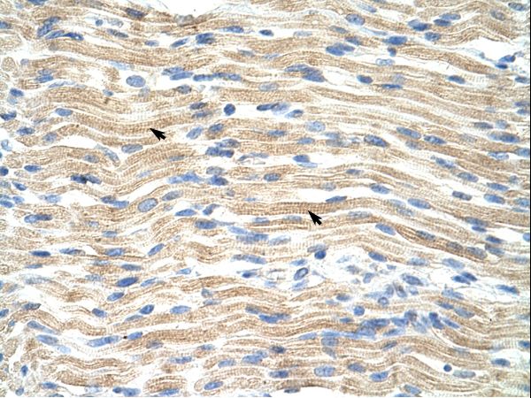 EXOSC6 Antibody - EXOSC6 antibody ARP41087_T100-NP_478126-EXOSC6 (exosome component 6) Antibody was used in IHC to stain formalin-fixed, paraffin-embedded human muscle.  This image was taken for the unconjugated form of this product. Other forms have not been tested.