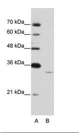 EXOSC6 Antibody - A: Marker, B: Jurkat Cell Lysate.  This image was taken for the unconjugated form of this product. Other forms have not been tested.