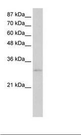 EXOSC6 Antibody - Jurkat Cell Lysate.  This image was taken for the unconjugated form of this product. Other forms have not been tested.