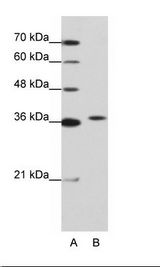 EXOSC7 Antibody - A: Marker, B: Jurkat Cell Lysate.  This image was taken for the unconjugated form of this product. Other forms have not been tested.