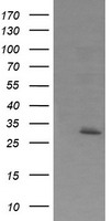 EXOSC7 Antibody - HEK293T cells were transfected with the pCMV6-ENTRY control (Left lane) or pCMV6-ENTRY EXOSC7 (Right lane) cDNA for 48 hrs and lysed. Equivalent amounts of cell lysates (5 ug per lane) were separated by SDS-PAGE and immunoblotted with anti-EXOSC7.