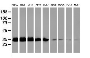 EXOSC7 Antibody - Western blot of extracts (35 ug) from 9 different cell lines by using anti-EXOSC7 monoclonal antibody (HepG2: human; HeLa: human; SVT2: mouse; A549: human; COS7: monkey; Jurkat: human; MDCK: canine; PC12: rat; MCF7: human).