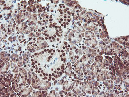 EXOSC7 Antibody - IHC of paraffin-embedded Human pancreas tissue using anti-EXOSC7 mouse monoclonal antibody.