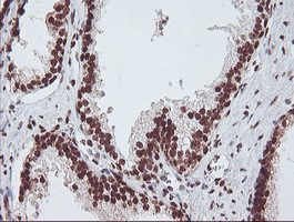 EXOSC7 Antibody - IHC of paraffin-embedded Human prostate tissue using anti-EXOSC7 mouse monoclonal antibody.