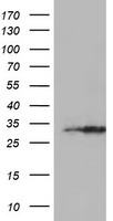 EXOSC7 Antibody - HEK293T cells were transfected with the pCMV6-ENTRY control (Left lane) or pCMV6-ENTRY EXOSC7 (Right lane) cDNA for 48 hrs and lysed. Equivalent amounts of cell lysates (5 ug per lane) were separated by SDS-PAGE and immunoblotted with anti-EXOSC7.