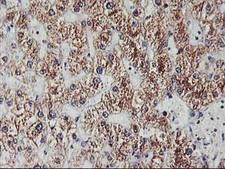 EXOSC7 Antibody - IHC of paraffin-embedded Human liver tissue using anti-EXOSC7 mouse monoclonal antibody.