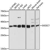 EXOSC7 Antibody - Western blot analysis of extracts of various cell lines using EXOSC7 Polyclonal Antibody at dilution of 1:3000.