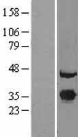 EXOSC7 Protein - Western validation with an anti-DDK antibody * L: Control HEK293 lysate R: Over-expression lysate