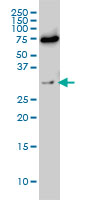 EXOSC8 Antibody - EXOSC8 monoclonal antibody (M01), clone 1G5 Western blot of EXOSC8 expression in HeLa NE.
