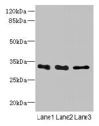 EXOSC8 Antibody - Western blot All lanes: EXOSC8 antibody at 4µg/ml Lane 1: Mouse small intestine tissue Lane 2: Hela whole cell lysate Lane 3: K562 whole cell lysate Secondary Goat polyclonal to rabbit IgG at 1/10000 dilution Predicted band size: 31 kDa Observed band size: 31 kDa