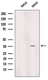 EXOSC8 Antibody - Western blot analysis of extracts of HeLa cells using EXOSC8 antibody. The lane on the left was treated with blocking peptide.