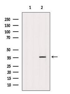 EXOSC8 Antibody - Western blot analysis of extracts of MCF-7 using EXOSC8 antibody. The lane on the left was treated with blocking peptide.