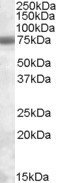 EXOSC9 / p5 Antibody - EXOSC9 antibody (0.3 ug/ml) staining of Jurkat lysate (35 ug protein/ml in RIPA buffer). Primary incubation was 1 hour. Detected by chemiluminescence.