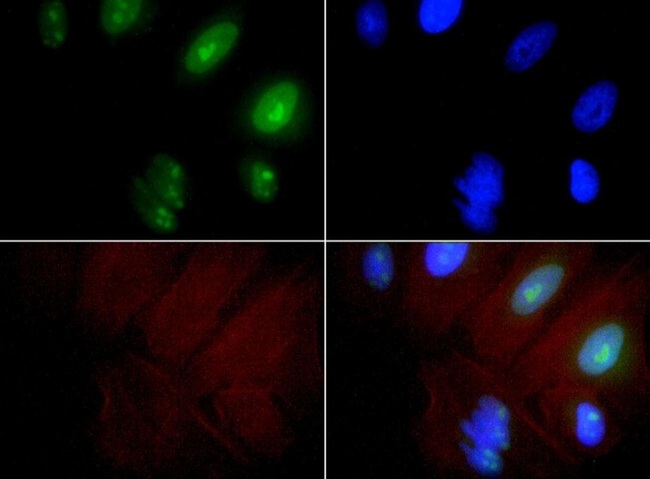 EXOSC9 / p5 Antibody - Immunocytochemistry/Immunofluorescence: Exosome Component 9 Antibody - EXOSC9 antibody was tested at 1:100 in HeLa cells with FITC (green). Nuclei and actin were counterstained with Dapi (blue) and Phalloidin (red).  This image was taken for the unconjugated form of this product. Other forms have not been tested.
