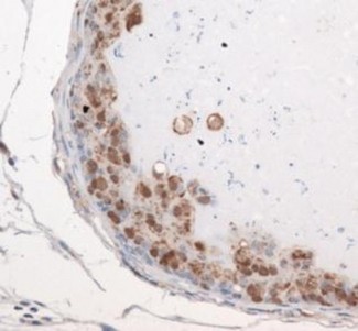 EXOSC9 / p5 Antibody - Immunohistochemistry: Exosome Component 9 Antibody - Staining of EXOSC9 in mouse prostate.  This image was taken for the unconjugated form of this product. Other forms have not been tested.