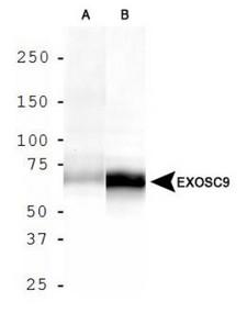 EXOSC9 / p5 Antibody - Western Blot: Exosome Component 9 Antibody - Analysis of EXOSC9 in A. HepG2 cell lysate and B. MCF7 cell lysate.  This image was taken for the unconjugated form of this product. Other forms have not been tested.