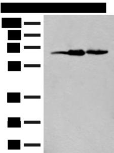 EXOSC9 / p5 Antibody - Western blot analysis of 293T cell lysates  using EXOSC9 Polyclonal Antibody at dilution of 1:400