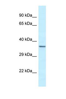 EXOSC9 / p5 Antibody - EXOSC9 antibody Western blot of Fetal Heart lysate. Antibody concentration 1 ug/ml.  This image was taken for the unconjugated form of this product. Other forms have not been tested.