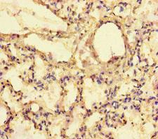 EXPH5 Antibody - Immunohistochemistry of paraffin-embedded human lung tissue at dilution of 1:100
