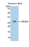 EXT1 Antibody - Western blot of recombinant EXT1.  This image was taken for the unconjugated form of this product. Other forms have not been tested.