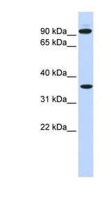 EXT2 Antibody - EXT2 antibody Western blot of 721_B cell lysate. This image was taken for the unconjugated form of this product. Other forms have not been tested.