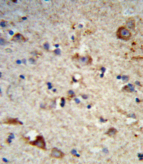 EXT2 Antibody - Formalin-fixed and paraffin-embedded human brain tissue reacted with EXT2 Antibody , which was peroxidase-conjugated to the secondary antibody, followed by DAB staining. This data demonstrates the use of this antibody for immunohistochemistry; clinical relevance has not been evaluated.