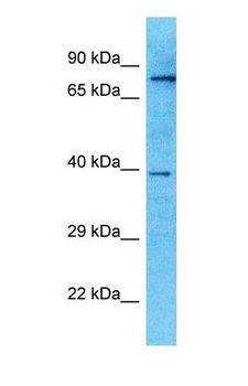 EXT2 Antibody - Western blot of EXT2 Antibody with human Placenta lysate.  This image was taken for the unconjugated form of this product. Other forms have not been tested.