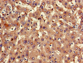 EXT2 Antibody - Immunohistochemistry of paraffin-embedded human liver tissue using EXT2 Antibody at dilution of 1:100