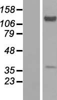 EXTL2 Protein - Western validation with an anti-DDK antibody * L: Control HEK293 lysate R: Over-expression lysate
