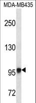 EXTL3 Antibody - EXTL3 Antibody western blot of MDA-MB435 cell line lysates (35 ug/lane). The EXTL3 antibody detected the EXTL3 protein (arrow).